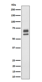 Western blot analysis of PPP2R5D expression in human HeLa cell lysate. Major bands are observed near 60 kDa and 70 kDa, with the upper species appearing as a doublet, consistent with phosphorylated and unmodified forms of PPP2R5D (predicted ~66 kDa).