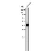 Rat kidney tissue lysate tested with the CASP6 antibody at 1:1000 dilution for 1 hour at room temperature. Expected molecular weight: 34-36 kDa.