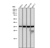 All lanes use the CASP6 antibody at 1:1000 dilution for 1 hour at room temperature. Expected molecular weight: 34-36 kDa.