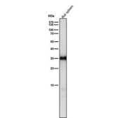 Rat spleen tissue lysate tested with the CASP6 antibody at 1:1000 dilution for 1 hour at room temperature. Expected molecular weight: 34-36 kDa.
