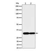Western blot analysis of Caspase-6 expression in (1) mouse spleen lysate; (2) rat kidney cell lysate using CASP6 antibody. Expected molecular weight: 34-36 kDa.