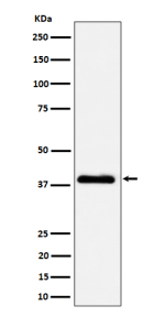 Western blot analysis of NSDHL expression in A431 cell lysate using NSDHL antibody. The expected molecular weight of NSDHL is ~42 kDa.