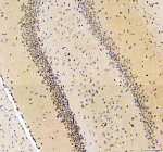 Immunohistochemical staining of MAPK14 using anti- MAPK14 antibody. MAPK14 was detected in a paraffin-embedded section of rat brain tissue. Heat mediated antigen retrieval was performed in EDTA buffer (pH 8.0, epitope retrieval solution). The tissue section was blocked with 10% goat serum. The tissue section was then incubated with 2 ug/ml rabbit anti- MAPK14 antibody overnight at 4oC. Peroxidase Conjugated Goat Anti-rabbit IgG was used as secondary antibody and incubated for 30 minutes at 37oC. The tissue section was developed using an HRP secondary and DAB substrate.