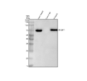 Immunoprecipitation of IRF2BP1 protein from 500ug of human HepG2 whole cell lysate with 2ug of IRF2BP1 antibody. A band is observed at approximately 70-72 kDa, consistent with the known electrophoretic mobility of phosphorylated full-length IRF2BP1 (predicted ~62 kDa).