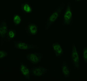 Immunofluorescent staining of FFPE human TPC-1 cells with IRF2BP1 antibody (green). HIER: steam section in pH6 citrate buffer for 20 min.