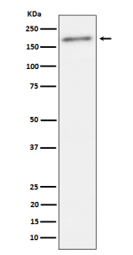 Western blot analysis of Phospho-ErbB2(Y1221 + Y1222) expression in human SKBR3 cell lysate using Phospho-ErbB2 (Tyr1221/Tyr1222) antibody. A single band is detected at approximately 190â200 kDa, consistent with the phosphorylated, full-length form of the ErbB2/HER2 receptor.