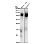 All lanes use the PKC delta/theta Antibody at 1:1000 dilution for 1 hour at room temperature. Predicted molecular weight: 68-82 kDa.