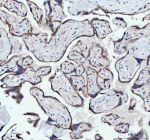 Immunohistochemical staining of NDUFAB1 using anti-NDUFAB1 antibody. NDUFAB1 was detected in a paraffin-embedded section of human placenta tissue. Heat mediated antigen retrieval was performed in EDTA buffer (pH 8.0, epitope retrieval solution). The tissue section was blocked with 10% goat serum. The tissue section was then incubated with 1:50 rabbit anti-NDUFAB1 antibody overnight at 4oC. Peroxidase Conjugated Goat Anti-rabbit IgG was used as secondary antibody and incubated for 30 minutes at 37oC. The tissue section was developed using an HRP secondary and DAB substrate.