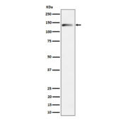 Western blot analysis of Delta 2 Catenin expression in mouse brain cell lysate using CTNND2 antibody. Predicted molecular weight ~133 kDa.