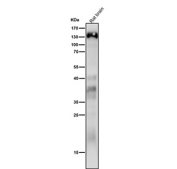 Western blot analysis of Delta 2 Catenin expression in rat brain cell lysate using CTNND2 antibody. Predicted molecular weight ~133 kDa.