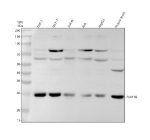 Western blot analysis of PEX11B using anti-PEX11B antibody. Electrophoresis was performed on a 10% SDS-PAGE gel at 80V (Stacking gel) / 120V (Resolving gel) for 2 hours. Lane 1: human THP-1 whole cell lysates, Lane 2: human MCF-7 whole cell lysates, Lane 3: human Jurkat whole cell lysates, Lane 4: human REH whole cell lysates, Lane 5: human HepG2 whole cell lysates, Lane 6: mouse testis tissue lysates. After electrophoresis, proteins were transferred to a nitrocellulose membrane at 150 mA for 50-90 minutes. Blocked the membrane with 5% non-fat milk/TBS for 1.5 hour at RT. The membrane was incubated with rabbit anti-PEX11B antibody at 1:500 overnight at 4oC, then washed with TBS-0.1%Tween 3 times with 5 minutes each and probed with a goat anti-rabbit IgG-HRP secondary antibody at a dilution of 1:5000 for 1.5 hour at RT. The signal was developed using an ECL Plus Western Blotting Substrate. Western blot detection of PEX11B in human cell lines reveals the expected ~25 kDa monomer band, as well as consistent higher-molecular-weight bands at ~65 kDa and ~80 kDa. The higher bands likely reflect stable PEX11B dimers/trimeric oligomers or PEX11B-containing complexes as previously documented for PEX11B self-interaction.