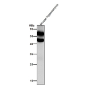 Mouse brain tissue lysate tested with the Phospho-CaMKII alpha (T286) antibody at 1:2000 dilution for 1 hour at room temperature. Phospho-CaMKII western of mouse hippocampus using pT286 antibody shows a ~50 kDa band (CaMKII alpha) and a ~60 kDa band (possible cross-reactive CaMKII beta pT287), consistent with isoform expression in hippocampus and phosphorylation-dependent mobility shifts.