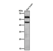 Rat brain tissue lysate tested with the Phospho-CaMKII alpha (T286) antibody at 1:2000 dilution for 1 hour at room temperature.