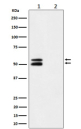 Phospho-CaMKII alpha (Thr286) western blot of mouse brain using Phospho-CaMKII alpha (T286) antibody. Lane 1, strong ~50/55 kDa doublet consistent with different phosphorylation states of CaMKII alpha; lane 2, lambda phosphatase treatment abolishes the signal, confirming phospho-specificity.