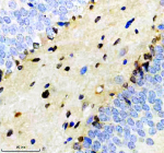 Immunohistochemical staining of CRKL using anti-CRKL antibody. CRKL was detected in a paraffin-embedded section of rat brain tissue. Heat mediated antigen retrieval was performed in EDTA buffer (pH 8.0, epitope retrieval solution). The tissue section was blocked with 10% goat serum. The tissue section was then incubated with 1:50 rabbit anti-CRKL antibody overnight at 4oC. Peroxidase Conjugated Goat Anti-rabbit IgG was used as secondary antibody and incubated for 30 minutes at 37oC. The tissue section was developed using an HRP secondary and DAB substrate.