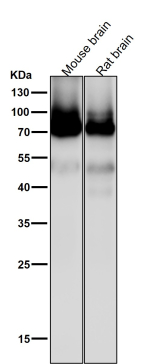 All lanes use the Pan-PKC antibody at 1:2000 dilution for 1 hour at room temperature. Expected molecular weight: 68-77 kDa.