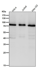All lanes use the Pan-PKC antibody at 1:2000 dilution for 1 hour at room temperature. Expected molecular weight: 68-77 kDa.