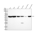 Western blot analysis of Neurokinin 1 Receptor using anti-NKR1 antibody. Lane 1: human Raji whole cell lysates, Lane 2: human K562 whole cell lysates, Lane 3: human MOLT-4 whole cell lysates, Lane 4: rat spleen tissue lysates, Lane 5: mouse kidney tissue lysates, Lane 6: mouse spleen tissue lysates. After electrophoresis, proteins were transferred to a nitrocellulose membrane at 150 mA for 50-90 minutes. Blocked the membrane with 5% non-fat milk/TBS for 1.5 hour at RT. The membrane was incubated with rabbit anti-NKR1 antibody at 1:1000 overnight at 4oC, then washed with TBS-0.1%Tween 3 times with 5 minutes each and probed with a goat anti-rabbit IgG-HRP secondary antibody at a dilution of 1:5000 for 1.5 hour at RT. The signal was developed using enhanced chemiluminescent. The expected molecular weight of Neurokinin 1 Receptor is at 46 kDa.