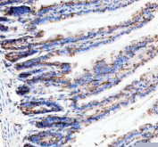Immunohistochemical staining of Neurokinin 1 Receptor using anti-NKR1 antibody. Neurokinin 1 Receptor was detected in a paraffin-embedded section of mouse colon tissue. Heat mediated antigen retrieval was performed in EDTA buffer (pH 8.0, epitope retrieval solution). The tissue section was blocked with 10% goat serum. The tissue section was then incubated with 1:50 rabbit anti-NKR1 antibody overnight at 4oC. Peroxidase Conjugated Goat Anti-rabbit IgG was used as secondary antibody and incubated for 30 minutes at 37oC. The tissue section was developed using an HRP secondary and DAB substrate.