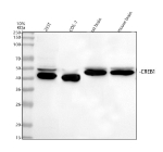 Western blot analysis of CREB1 using anti-CREB1 antibody. Lane 1: human 293T whole cell lysates, Lane 2: monkey COS-7 whole cell lysates, Lane 3: rat brain tissue lysates, Lane 4: mouse brain tissue lysates. After electrophoresis, proteins were transferred to a nitrocellulose membrane at 150 mA for 50-90 minutes. Blocked the membrane with 5% non-fat milk/TBS for 1.5 hour at RT. The membrane was incubated with rabbit anti-CREB1 antibody at 0.5 ug/ml overnight at 4oC, then washed with TBS-0.1%Tween 3 times with 5 minutes each and probed with a goat anti-rabbit IgG-HRP secondary antibody at a dilution of 1:5000 for 1.5 hour at RT. The signal was developed using enhanced chemiluminescent. CREB1 western blot of human, monkey, and rodent samples shows a characteristic doublet: a lower band near ~43-45 kDa and an upper band at ~48-50 kDa. The upper species corresponds to post-translationally modified (phosphorylated) CREB1, which commonly runs above its predicted ~37 kDa.