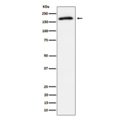 Western blot analysis of Phospho-AS160 (T642) expression in lysate from human 293T cells treated with insulin, using Phospho-AS160 (Thr642) antibody. Predicted molecular weight ~147 kDa, commonly observed at ~160 kDa.