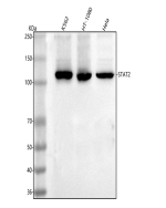 Western blot analysis of STAT2 using anti-STAT2 antibody. Lane 1: human K562 whole cell lysates, Lane 2: human HT-1080 whole cell lysates, Lane 3: human Hela whole cell lysates. After electrophoresis, proteins were transferred to a nitrocellulose membrane at 150 mA for 50-90 minutes. Blocked the membrane with 5% non-fat milk/TBS for 1.5 hour at RT. The membrane was incubated with rabbit anti-STAT2 antibody at 0.5 ug/ml overnight at 4oC, then washed with TBS-0.1%Tween 3 times with 5 minutes each and probed with a goat anti-rabbit IgG-HRP secondary antibody at a dilution of 1:5000 for 1.5 hour at RT. The signal was developed using enhanced chemiluminescent. Expected molecular weight: 98-113 kDa depending on phosphorylation level.