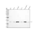 Western blot analysis of IL10 using anti-IL10 antibody. Lane 1: human U251 whole cell lysates, Lane 2: human Jurkat whole cell lysates, Lane 3: rat spleen tissue lysates, Lane 4: rat PC-12 whole cell lysates, Lane 5: mouse spleen tissue lysates, Lane 6: mouse RAW264.7 whole cell lysates. After electrophoresis, proteins were transferred to a nitrocellulose membrane at 150 mA for 50-90 minutes. Blocked the membrane with 5% non-fat milk/TBS for 1.5 hour at RT. The membrane was incubated with rabbit anti-IL10 antibody at 1:500 overnight at 4oC, then washed with TBS-0.1%Tween 3 times with 5 minutes each and probed with a goat anti-rabbit IgG-HRP secondary antibody at a dilution of 1:500 for 1.5 hour at RT. The signal was developed using enhanced chemiluminescent. Western blot of IL-10 in human and rodent spleen lysates shows a band at ~17-18 kDa, consistent with the mature, processed IL-10 monomer after removal of the signal peptide. The apparent size is slightly lower than the 21 kDa precursor predicted from the unprocessed sequence.