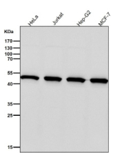 All lanes use the PSMC4 antibody at 1:3000 dilution for 1 hour at room temperature. Predicted molecular weight: 44-47 kDa (multiple isoforms).