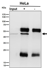 Immunoprecipitation analysis using the NFE2 antibody at 1:50 dilution. Western blot at 1:1000 dilution.