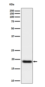 Western blot analysis of TNFAIP8 expression in human A549 cell lysate using TNFAIP8 antibody. TNFAIP8 western blot shows a predominant band at ~19 kDa. Although the predicted mass is ~23 kDa, TNFAIP8 commonly migrates at ~18-21 kDa due to electrophoretic mobility characteristics of small acidic proteins and possible isoform/alternative-start usage.
