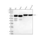 Western blot analysis of ACSL5 using anti-ACSL5 antibody. Lane 1: human RT4 whole cell lysates, Lane 2: human HepG2 whole cell lysates, Lane 3: rat liver tissue lysates, Lane 4: mouse liver tissue lysates. After electrophoresis, proteins were transferred to a nitrocellulose membrane at 150 mA for 50-90 minutes. Blocked the membrane with 5% non-fat milk/TBS for 1.5 hour at RT. The membrane was incubated with rabbit anti-ACSL5 antibody at 0.5 ug/ml overnight at 4oC, then washed with TBS-0.1%Tween 3 times with 5 minutes each and probed with a goat anti-rabbit IgG-HRP secondary antibody at a dilution of 1:5000 for 1.5 hour at RT. The signal was developed using enhanced chemiluminescent. ACSL5 western blot shows a predominant band at ~70 kDa in human cell lines and a stronger ~76 kDa band in rodent liver. The two closely spaced species are consistent with full-length ACSL5 and an N-terminally processed isoform, a known feature of this mitochondrial acyl-CoA synthetase.