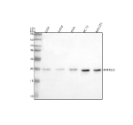 Western blot analysis of PLAAT4 using anti-PLAAT4 antibody. Electrophoresis was performed on a 12% SDS-PAGE gel at 80V (Stacking gel) / 120V (Resolving gel) for 2 hours. Lane 1: human U251 whole cell lysates, Lane 2: human Jurkat whole cell lysates, Lane 3: human SIHA whole cell lysates, Lane 4: rat PC-12 whole cell lysates, Lane 5: mouse NIH/3T3 whole cell lysates. After electrophoresis, proteins were transferred to a nitrocellulose membrane at 150 mA for 50-90 minutes. Blocked the membrane with 5% non-fat milk/TBS for 1.5 hour at RT. The membrane was incubated with rabbit anti-PLAAT4 antibody at 0.5 ug/ml overnight at 4oC, then washed with TBS-0.1%Tween 3 times with 5 minutes each and probed with a goat anti-rabbit IgG-HRP secondary antibody at a dilution of 1:5000 for 1.5 hour at RT. The signal was developed using an ECL Plus Western Blotting Substrate. The expected molecular weight of PLAAT4 is ~18 kDa.