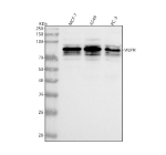 Western blot analysis of Melanophilin/MLPH using anti-MLPH antibody. Lane 1: human MCF-7 whole cell lysates, Lane 2: human whole cell lysates, Lane 3: human PC-3 whole cell lysates. After electrophoresis, proteins were transferred to a nitrocellulose membrane at 150 mA for 50-90 minutes. Blocked the membrane with 5% non-fat milk/TBS for 1.5 hour at RT. The membrane was incubated with rabbit anti-MLPH antibody at 0.25 ug/ml overnight at 4oC, then washed with TBS-0.1%Tween 3 times with 5 minutes each and probed with a goat anti-rabbit IgG-HRP secondary antibody at a dilution of 1:5000 for 1.5 hour at RT. The signal was developed using enhanced chemiluminescent. MLPH western blot shows a predominant band at ~85 kDa with adjacent upper and lower species. Although the theoretical mass is ~66 kDa, melanophilin commonly migrates higher due to phosphorylation and its low-complexity scaffold architecture; neighboring bands likely reflect differential modification states and minor proteolysis.