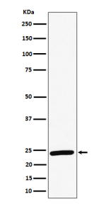 Western blot analysis of RAB8A expression in human HeLa cell lysate using RAB8A antibody. Predicted molecular weight ~24 kDa.