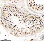 Immunohistochemical staining of GNAQ using anti-GNAQ antibody. GNAQ was detected in a paraffin-embedded section of human testis tissue. Heat mediated antigen retrieval was performed in EDTA buffer (pH 8.0, epitope retrieval solution). The tissue section was blocked with 10% goat serum. The tissue section was then incubated with 1:50 rabbit anti-GNAQ antibody overnight at 4oC. Peroxidase Conjugated Goat Anti-rabbit IgG was used as secondary antibody and incubated for 30 minutes at 37oC. The tissue section was developed using an HRP secondary and DAB substrate.