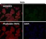 Immunofluorescent analysis using the GNAQ antibody (green) at 1:50 dilution.