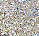 Immunohistochemical staining of CBR1 using anti-CBR1 antibody. CBR1 was detected in a paraffin-embedded section of human liver tissue. Heat mediated antigen retrieval was performed in EDTA buffer (pH 8.0, epitope retrieval solution). The tissue section was blocked with 10% goat serum. The tissue section was then incubated with 1:50 rabbit anti-CBR1 antibody overnight at 4oC. Peroxidase Conjugated Goat Anti-rabbit IgG was used as secondary antibody and incubated for 30 minutes at 37oC. The tissue section was developed using an HRP secondary and DAB substrate.