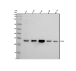 Western blot analysis of CBR1 using anti-CBR1 antibody. Electrophoresis was performed on a 10% SDS-PAGE gel at 80V (Stacking gel) / 120V (Resolving gel) for 2 hours. Lane 1: human Hela whole cell lysates, Lane 2: human whole cell lysates, Lane 3: human SIHA whole cell lysates, Lane 4: human whole cell lysates, Lane 5: rat PC-12 whole cell lysates. After electrophoresis, proteins were transferred to a nitrocellulose membrane at 150 mA for 50-90 minutes. Blocked the membrane with 5% non-fat milk/TBS for 1.5 hour at RT. The membrane was incubated with rabbit anti-CBR1 antibody at 1:500 overnight at 4oC, then washed with TBS-0.1%Tween 3 times with 5 minutes each and probed with a goat anti-rabbit IgG-HRP secondary antibody at a dilution of 1:5000 for 1.5 hour at RT. The signal was developed using an ECL Plus Western Blotting Substrate. A ~30 kDa band is detected in all samples, with a clear doublet in HeLa, A549, and SiHa lysates. The doublet pattern reflects phosphorylation and minor N-terminal isoform variation of CBR1 previously reported in epithelial cell models.