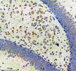 Immunohistochemical staining of CBR1 using anti-CBR1 antibody. CBR1 was detected in a paraffin-embedded section of mouse brain tissue. Heat mediated antigen retrieval was performed in EDTA buffer (pH 8.0, epitope retrieval solution). The tissue section was blocked with 10% goat serum. The tissue section was then incubated with 1:50 rabbit anti-CBR1 antibody overnight at 4oC. Peroxidase Conjugated Goat Anti-rabbit IgG was used as secondary antibody and incubated for 30 minutes at 37oC. The tissue section was developed using an HRP secondary and DAB substrate.