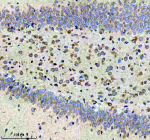Immunohistochemical staining of CBR1 using anti-CBR1 antibody. CBR1 was detected in a paraffin-embedded section of rat brain tissue. Heat mediated antigen retrieval was performed in EDTA buffer (pH 8.0, epitope retrieval solution). The tissue section was blocked with 10% goat serum. The tissue section was then incubated with 1:50 rabbit anti-CBR1 antibody overnight at 4oC. Peroxidase Conjugated Goat Anti-rabbit IgG was used as secondary antibody and incubated for 30 minutes at 37oC. The tissue section was developed using an HRP secondary and DAB substrate.