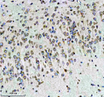Immunohistochemical staining of CBR1 using anti-CBR1 antibody. CBR1 was detected in a paraffin-embedded section of rat brain tissue. Heat mediated antigen retrieval was performed in EDTA buffer (pH 8.0, epitope retrieval solution). The tissue section was blocked with 10% goat serum. The tissue section was then incubated with 1:50 rabbit anti-CBR1 antibody overnight at 4oC. Peroxidase Conjugated Goat Anti-rabbit IgG was used as secondary antibody and incubated for 30 minutes at 37oC. The tissue section was developed using an HRP secondary and DAB substrate.
