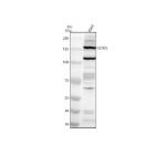Western blot analysis of SETD5 using anti-SETD5 antibody. Electrophoresis was performed on a 8% SDS-PAGE gel at 80V (Stacking gel) / 120V (Resolving gel) for 2 hours. Lane 1: human K562 whole cell lysates. After electrophoresis, proteins were transferred to a nitrocellulose membrane at 150 mA for 50-90 minutes. Blocked the membrane with 5% non-fat milk/TBS for 1.5 hour at RT. The membrane was incubated with rabbit anti-SETD5 antibody at 0.5 ug/ml overnight at 4oC, then washed with TBS-0.1%Tween 3 times with 5 minutes each and probed with a goat anti-rabbit IgG-HRP secondary antibody at a dilution of 1:5000 for 1.5 hour at RT. The signal was developed using an ECL Plus Western Blotting Substrate. A dominant band is observed near the expected ~158 kDa molecular weight, with an additional strong band at ~110-120 kDa. The lower band is consistent with truncated or alternatively spliced SETD5 isoforms described in the literature.