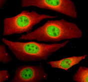 Immunofluorescent staining of NCAPG using anti-NCAPG antibody (green) and anti-Beta Tubulin antibody (red). NCAPG was detected in an immunocytochemical section of Hela cells. Enzyme antigen retrieval was performed using IHC enzyme antigen retrieval reagent for 15 mins. The cells were blocked with 10% goat serum. And then incubated with 5 ug/ml rabbit anti-NCAPG antibody and mouse anti-Beta Tubulin antibody overnight at 4oC. DyLight 488 Conjugated Goat Anti-Rabbit IgG and Cy3 Conjugated Goat Anti-Mouse IgG were used as secondary antibody at 1:500 dilution and incubated for 30 minutes at 37oC. Visualize using a fluorescence microscope and filter sets appropriate for the label used.