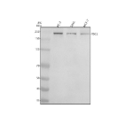 Western blot analysis of Tuberin/TSC2 (Phospho-S939) using anti-Phospho-Tuberin (Ser939) antibody. Electrophoresis was performed on a 8% SDS-PAGE gel at 80V (Stacking gel) / 120V (Resolving gel) for 2 hours. Lane 1: human PC-3 whole cell lysates, Lane 2: human SIHA whole cell lysates, Lane 3: human MCF-7 whole cell lysates. After electrophoresis, proteins were transferred to a nitrocellulose membrane at 150 mA for 50-90 minutes. Blocked the membrane with 5% non-fat milk/TBS for 1.5 hour at RT. The membrane was incubated with rabbit anti-Tuberin/TSC2 (Phospho-S939) antibody at a dilution of 1:500 overnight at 4oC, then washed with TBS-0.1%Tween 3 times with 5 minutes each and probed with a goat anti-rabbit IgG-HRP secondary antibody at a dilution of 1:5000 for 1.5 hour at RT. The signal was developed using an ECL Plus Western Blotting Substrate. A band is detected just below the 250 kDa marker, consistent with the known slower migration of hyperphosphorylated TSC2 relative to its ~201 kDa predicted mass. The upper mobility reflects multi-site phosphorylation of TSC2 and compression of large proteins on an 8% gel.