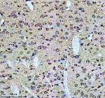 Immunohistochemical staining of Tuberin/TSC2 using anti-Tuberin/TSC2 antibody. Tuberin/TSC2 was detected in a paraffin-embedded section of rat brain tissue. Heat mediated antigen retrieval was performed in EDTA buffer (pH 8.0, epitope retrieval solution). The tissue section was blocked with 10% goat serum. The tissue section was then incubated with 1:50 rabbit anti-Tuberin/TSC2 antibody overnight at 4oC. Peroxidase Conjugated Goat Anti-rabbit IgG was used as secondary antibody and incubated for 30 minutes at 37oC. The tissue section was developed using an HRP secondary and DAB substrate.