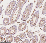 Immunohistochemical staining of MELTF using anti-MELTF antibody. MELTF was detected in a paraffin-embedded section of mouse testis tissue. Heat mediated antigen retrieval was performed in EDTA buffer (pH 8.0, epitope retrieval solution). The tissue section was blocked with 10% goat serum. The tissue section was then incubated with 2 ug/ml rabbit anti-MELTF antibody overnight at 4oC. Peroxidase Conjugated Goat Anti-rabbit IgG was used as secondary antibody and incubated for 30 minutes at 37oC. The tissue section was developed using an HRP secondary and DAB substrate.