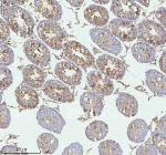 Immunohistochemical staining of MELTF using anti-MELTF antibody. MELTF was detected in a paraffin-embedded section of rat testis tissue. Heat mediated antigen retrieval was performed in EDTA buffer (pH 8.0, epitope retrieval solution). The tissue section was blocked with 10% goat serum. The tissue section was then incubated with 2 ug/ml rabbit anti-MELTF antibody overnight at 4oC. Peroxidase Conjugated Goat Anti-rabbit IgG was used as secondary antibody and incubated for 30 minutes at 37oC. The tissue section was developed using an HRP secondary and DAB substrate.