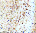 Immunohistochemical staining of Synaptotagmin-10/SYT10 using anti-SYT10 antibody. Synaptotagmin-10/SYT10 was detected in a paraffin-embedded section of mouse brain tissue. Heat mediated antigen retrieval was performed in EDTA buffer (pH 8.0, epitope retrieval solution). The tissue section was blocked with 10% goat serum. The tissue section was then incubated with 2 ug/ml rabbit anti-SYT10 antibody overnight at 4oC. Peroxidase Conjugated Goat Anti-rabbit IgG was used as secondary antibody and incubated for 30 minutes at 37oC. The tissue section was developed using an HRP secondary and DAB substrate.