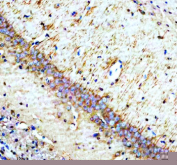 Immunohistochemical staining of Synaptotagmin-10/SYT10 using anti-SYT10 antibody. Synaptotagmin-10/SYT10 was detected in a paraffin-embedded section of rat brain tissue. Heat mediated antigen retrieval was performed in EDTA buffer (pH 8.0, epitope retrieval solution). The tissue section was blocked with 10% goat serum. The tissue section was then incubated with 2 ug/ml rabbit anti-SYT10 antibody overnight at 4oC. Peroxidase Conjugated Goat Anti-rabbit IgG was used as secondary antibody and incubated for 30 minutes at 37oC. The tissue section was developed using an HRP secondary and DAB substrate.