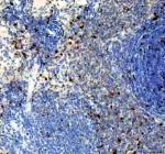 Immunohistochemical staining of Ki67/MKI67 using anti-Ki-67 antibody. Ki67/MKI67 was detected in a paraffin-embedded section of rat spleen tissue. Heat mediated antigen retrieval was performed in EDTA buffer (pH 8.0, epitope retrieval solution). The tissue section was blocked with 10% goat serum. The tissue section was then incubated with 1:50 rabbit anti-Ki-67 antibody overnight at 4oC. Peroxidase Conjugated Goat Anti-rabbit IgG was used as secondary antibody and incubated for 30 minutes at 37oC. The tissue section was developed using an HRP secondary and DAB substrate.